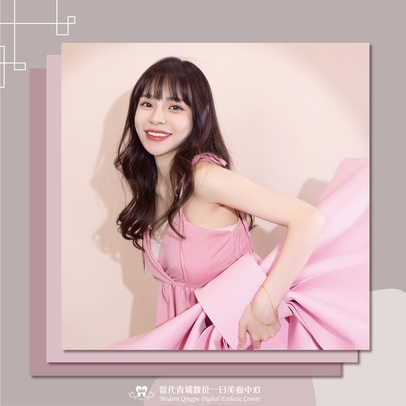 女星詩亞重做陶瓷牙齒貼片後,露出白皙透亮的微笑曲線