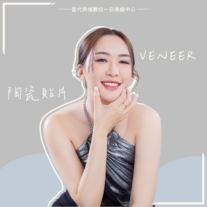 高雄患者來桃園完成陶瓷貼片，露出白皙自然的微笑曲線牙齒