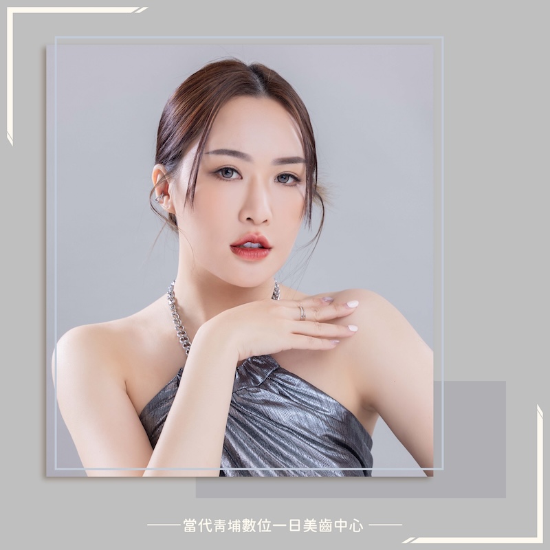 高雄患者來桃園完成陶瓷貼片，露出白皙自然的微笑曲線牙齒