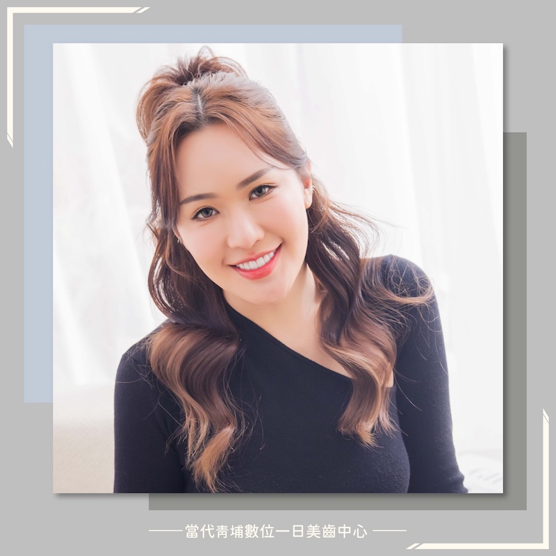 高雄患者來桃園完成陶瓷貼片，露出白皙自然的微笑曲線牙齒