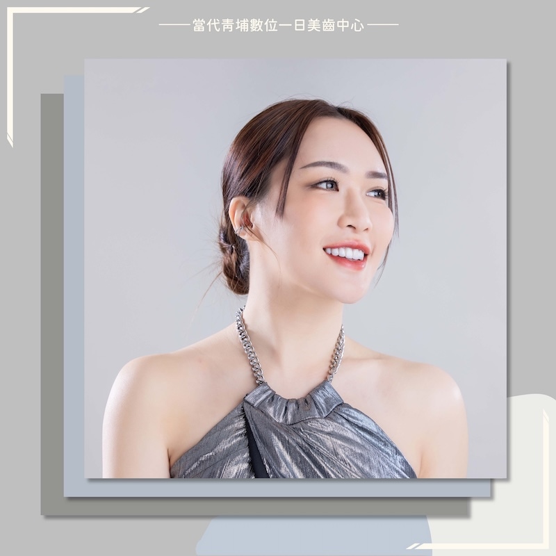 高雄患者來桃園完成陶瓷貼片，露出白皙自然的微笑曲線牙齒