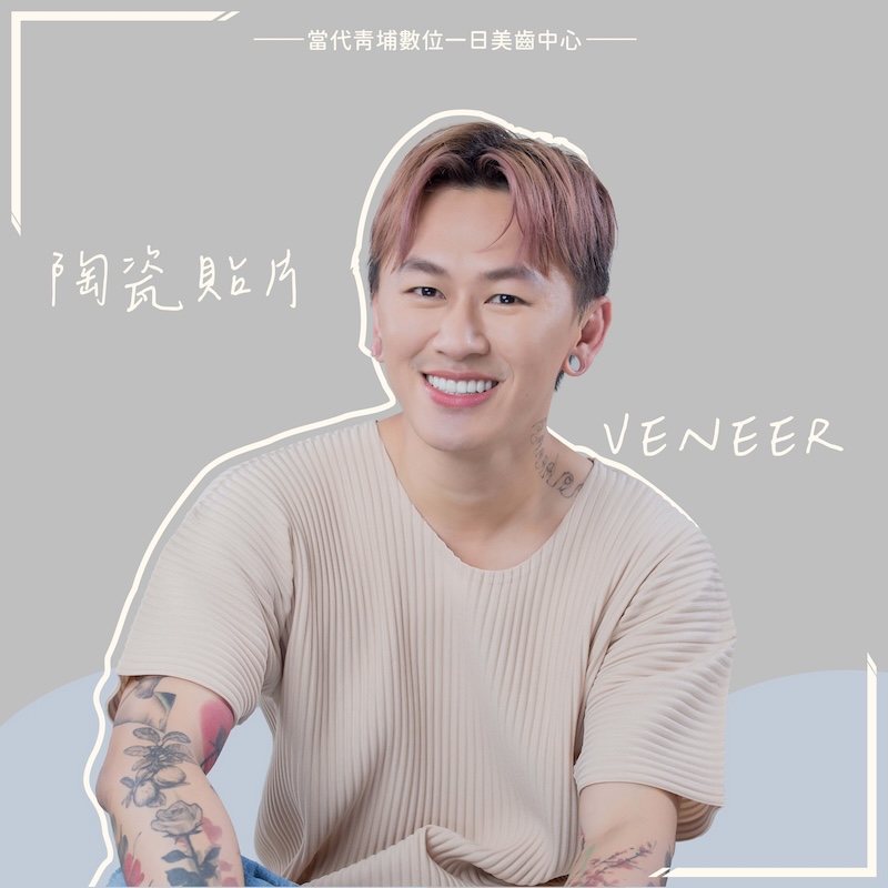 高雄霧眉師素梅老師來桃園完成陶瓷貼片，大幅提升整體笑容美觀