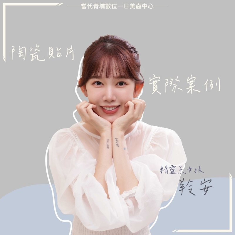 羚安完成陶瓷貼片療程後的美齒寫真,展現自然亮白的齒色與精緻微笑曲線