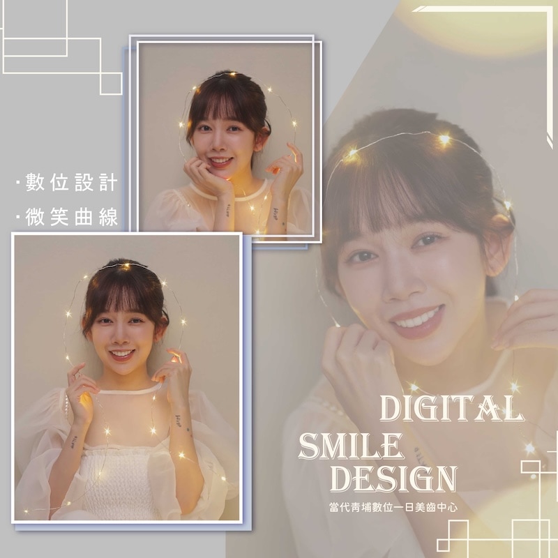 羚安完成陶瓷貼片療程後的美齒寫真,展現自然亮白的齒色與精緻微笑曲線