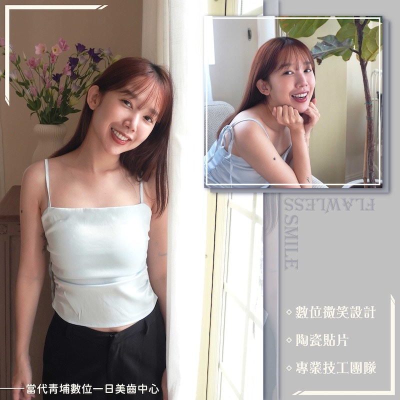 羚安完成陶瓷貼片療程後的美齒寫真,展現自然亮白的齒色與精緻微笑曲線
